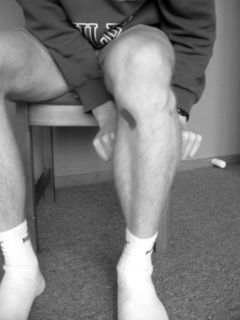 ptriggerpointanteriorpain